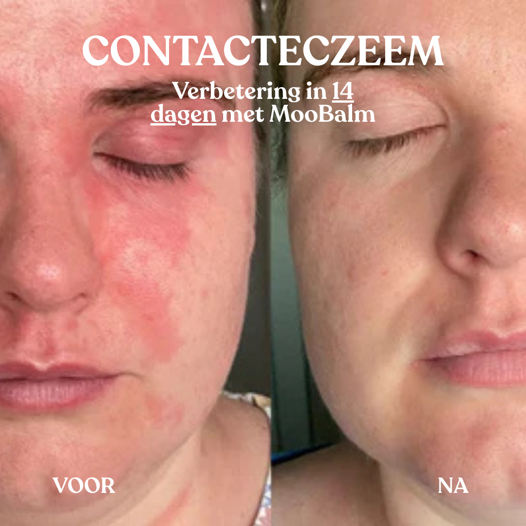 MooBalm Calming