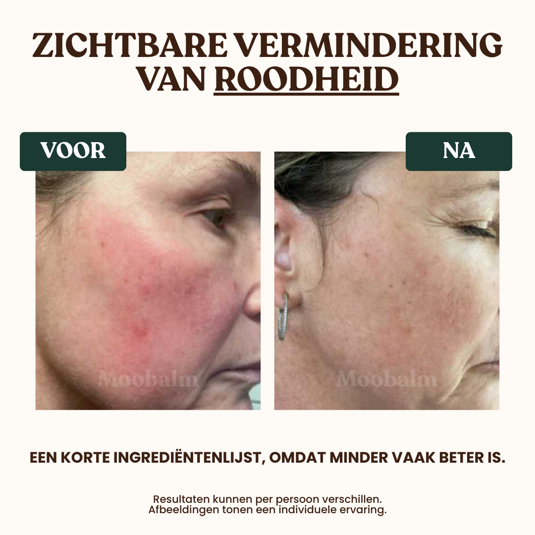 MooBalm Soft
