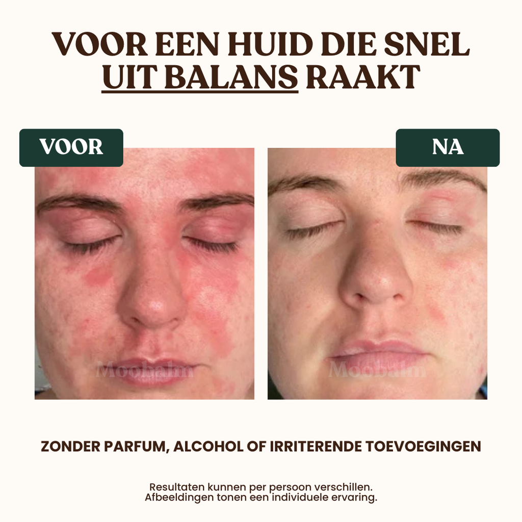 MooBalm Original